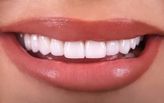 Porcelain veneers Century City